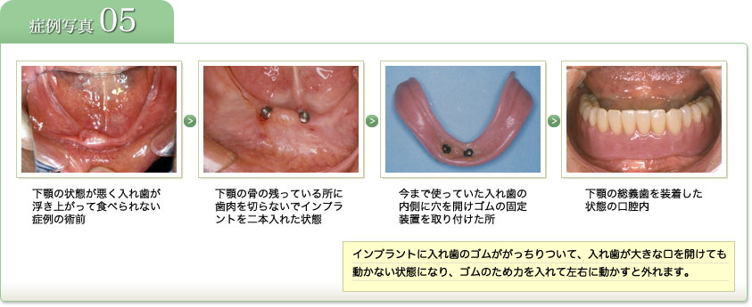 症例写真5